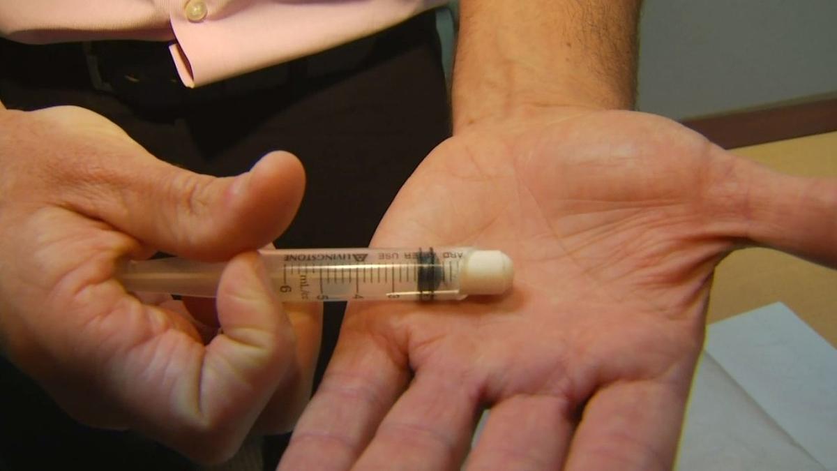 Процедура вшивания: последовательность действий в манипуляционном кабинете